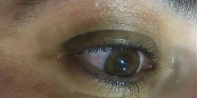 micropigmentacion-ojos-1-antes