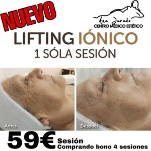 lifting-iónbico-1-sola-sesion